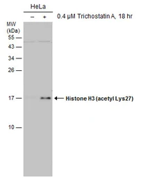 Anti-Histone H3K27ac (Acetyl Lys27) antibody [GT261] used in Western Blot (WB). GTX633652